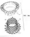 Fig. 16 - Helical anchor implantation