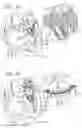 Fig. 18 - Helical anchor implantation