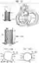Fig. 27 - Helical anchor implantation