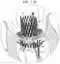 Fig. 28 - Helical anchor implantation