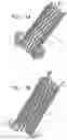 Fig. 30 - Helical anchor implantation