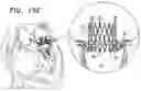 Fig. 35 - Helical anchor implantation