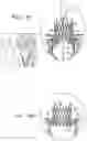 Fig. 40 - Helical anchor implantation