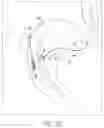 Fig. 11 - Tissue repair device
