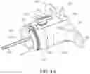 Fig. 05 - Flexible anchor delivery system