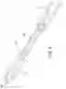 Fig. 17 - Flexible anchor delivery system