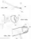 Fig. 27 - Flexible anchor delivery system