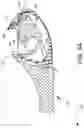 Fig. 04 - Loader for surgical suturing