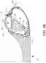 Fig. 05 - Loader for surgical suturing