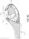 Fig. 06 - Loader for surgical suturing