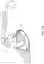 Fig. 13 - Loader for surgical suturing