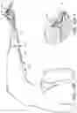 Fig. 18 - Loader for surgical suturing