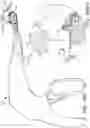 Fig. 19 - Loader for surgical suturing