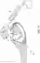 Fig. 20 - Loader for surgical suturing