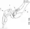 Fig. 24 - Loader for surgical suturing