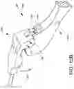 Fig. 25 - Loader for surgical suturing