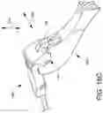 Fig. 26 - Loader for surgical suturing