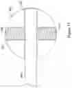 Fig. 16 - Endoscopic suturing needle and suture assembly attachment methods