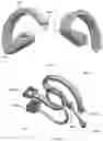 Fig. 27 - Laparoscopic suturing devices, needles, sutures, and drive systems
