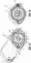 Fig. 12 - Adaptor for surgical instrument for converting rotary input to linear output