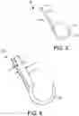Fig. 03 - Delivery tools for medical implants and methods of using the same