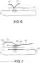 Fig. 05 - Delivery tools for medical implants and methods of using the same