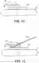 Fig. 07 - Delivery tools for medical implants and methods of using the same