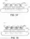 Fig. 09 - Delivery tools for medical implants and methods of using the same