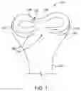 Fig. 02 - Self-cinching suture construct apparatus