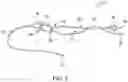 Fig. 03 - Self-cinching suture construct apparatus