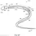 Fig. 05 - Self-cinching suture construct apparatus