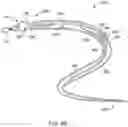 Fig. 06 - Self-cinching suture construct apparatus
