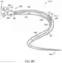 Fig. 08 - Self-cinching suture construct apparatus