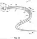 Fig. 09 - Self-cinching suture construct apparatus