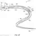 Fig. 10 - Self-cinching suture construct apparatus