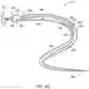 Fig. 11 - Self-cinching suture construct apparatus