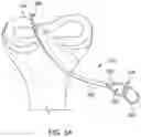 Fig. 14 - Self-cinching suture construct apparatus