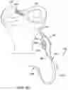 Fig. 21 - Self-cinching suture construct apparatus