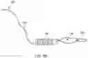 Fig. 24 - Self-cinching suture construct apparatus