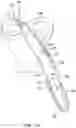 Fig. 34 - Self-cinching suture construct apparatus