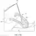 Fig. 48 - Self-cinching suture construct apparatus