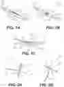 Fig. 02 - SUTURE NEEDLE DEVICES AND SUTURE ATTACHMENT METHODS