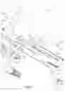 Fig. 07 - Surgical instrument with detection sensors