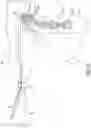 Fig. 63 - Surgical instrument with detection sensors