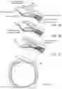 Fig. 03 - Abdominal closure method and device for ventral hernia