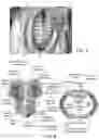 Fig. 06 - Abdominal closure method and device for ventral hernia
