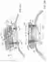 Fig. 10 - Abdominal closure method and device for ventral hernia
