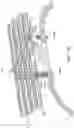 Fig. 11 - Abdominal closure method and device for ventral hernia