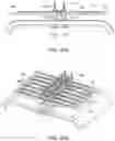 Fig. 25 - Abdominal closure method and device for ventral hernia