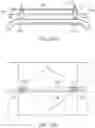 Fig. 26 - Abdominal closure method and device for ventral hernia